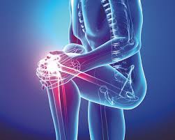 Rheumatology